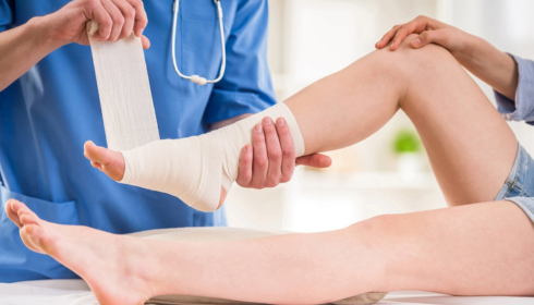 Physiotherapy After Ankle Sprain: Why “Just Resting” Is Not Always Enough